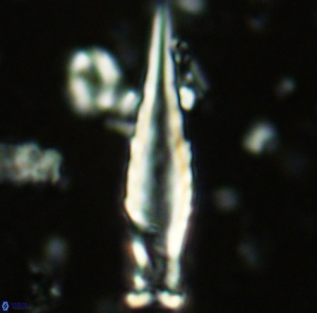 Rhabdosphaera inflata VR 02636