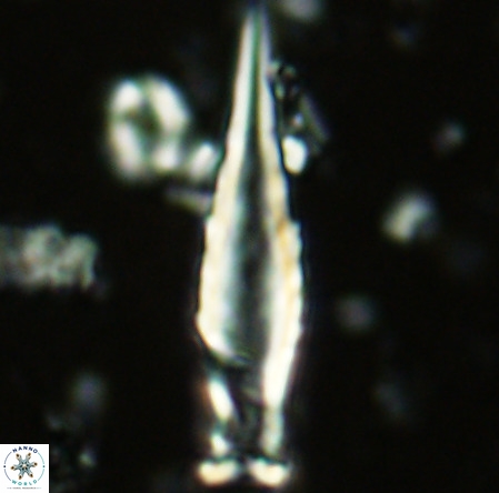 Rhabdosphaera inflata VR 02636