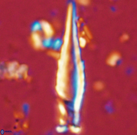 Rhabdosphaera inflata VR 02637