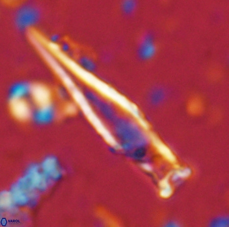 Rhabdosphaera inflata VR 02638