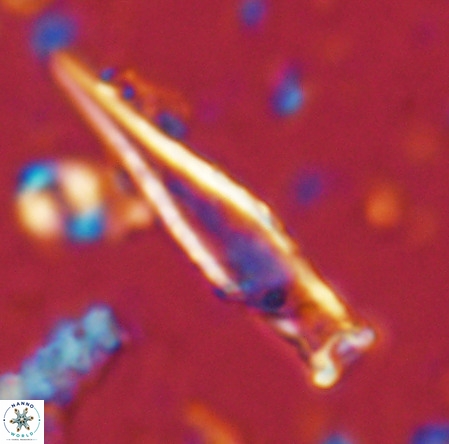 Rhabdosphaera inflata VR 02638