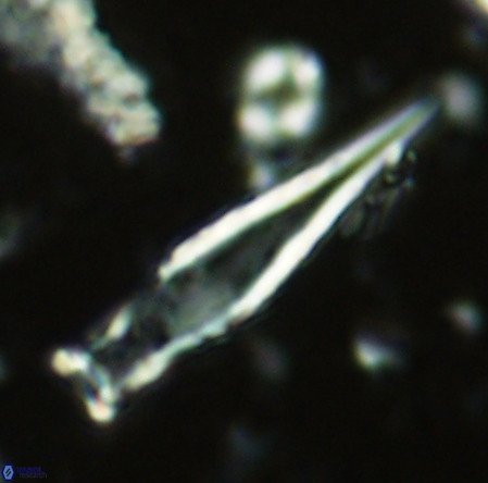 Rhabdosphaera inflata VR 02640
