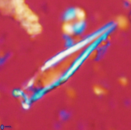 Rhabdosphaera inflata VR 02641