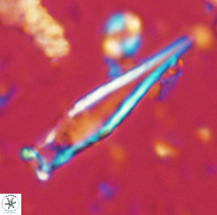 Rhabdosphaera inflata VR 02641