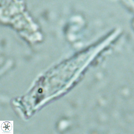 Rhabdosphaera inflata VR 02642
