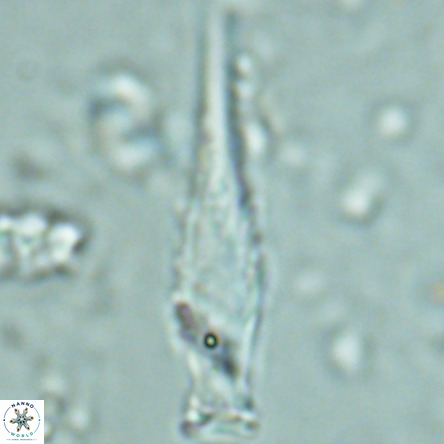 Rhabdosphaera inflata VR 02643