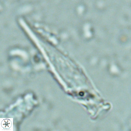 Rhabdosphaera inflata VR 02645