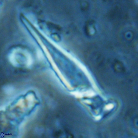 Rhabdosphaera inflata VR 02647