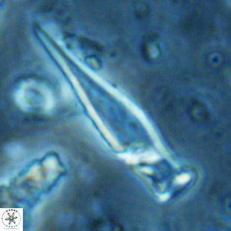 Rhabdosphaera inflata VR 02647