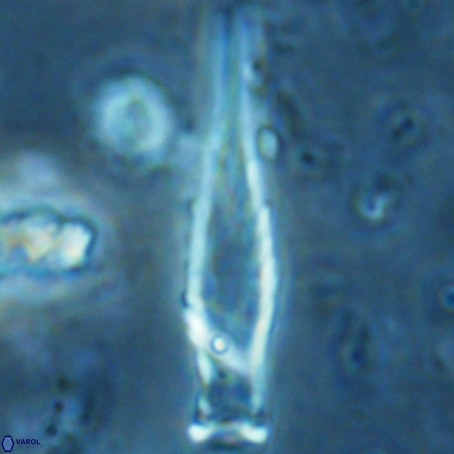 Rhabdosphaera inflata VR 02649