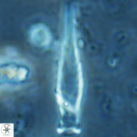 Rhabdosphaera inflata VR 02649