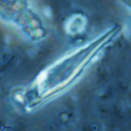 Rhabdosphaera inflata VR 02650