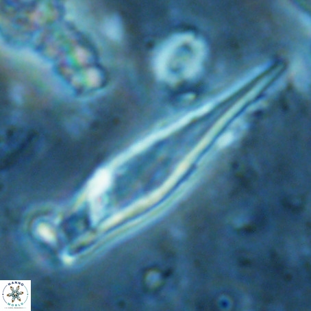 Rhabdosphaera inflata VR 02650
