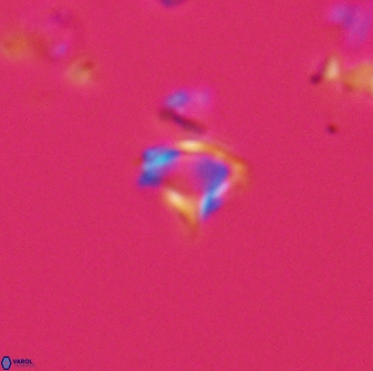 Rhabdosphaera poculii 22707