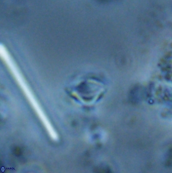 Rhabdosphaera poculii 27606