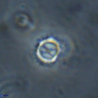 Rotelapillus tesserisbares 14888