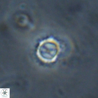 Rotelapillus tesserisbares 14888