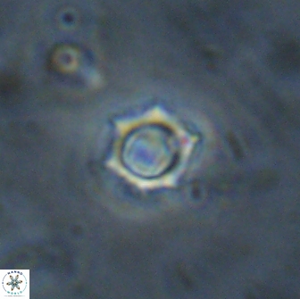 Rotelapillus tesserisbares 14889