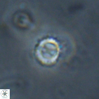 Rotelapillus tesserisbares 14890