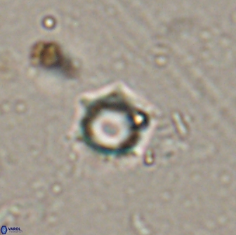 Rotelapillus tesserisbares 14891