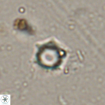 Rotelapillus tesserisbares 14891