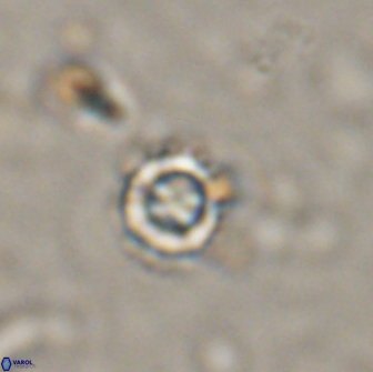 Rotelapillus tesserisbares 14893