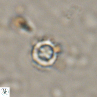 Rotelapillus tesserisbares 14893