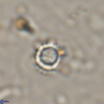 Rotelapillus tesserisbares 14894