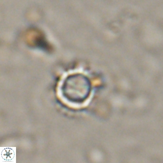 Rotelapillus tesserisbares 14894