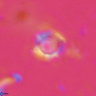 Rotelapillus tesserisbares 14896