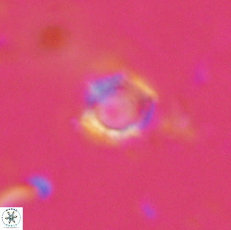 Rotelapillus tesserisbares 14896