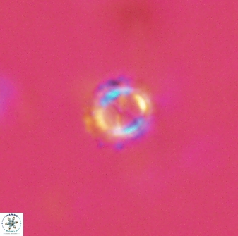 Rotelapillus tesserisbares 14900