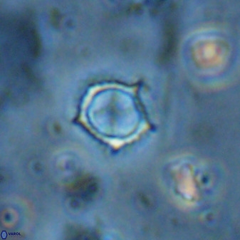 Rotelapillus tesserisbares 35842