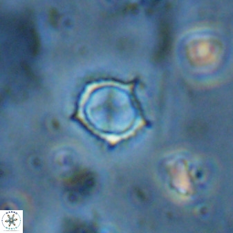 Rotelapillus tesserisbares 35842