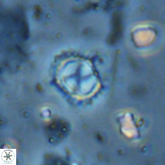 Rotelapillus tesserisbares 35843