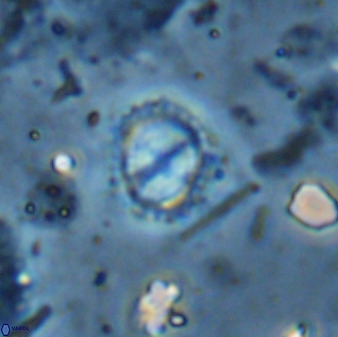 Rotelapillus tesserisbares 35844