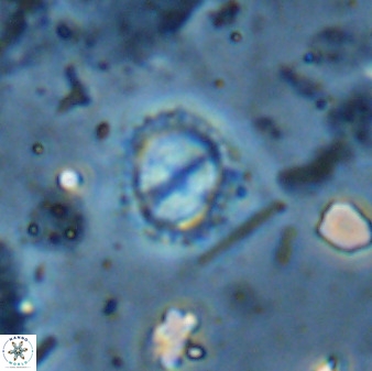 Rotelapillus tesserisbares 35844