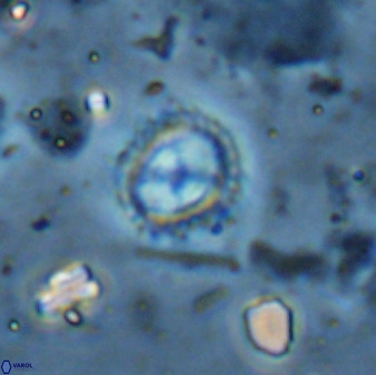 Rotelapillus tesserisbares 35845