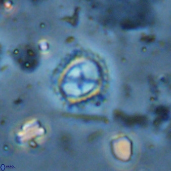 Rotelapillus tesserisbares 35846