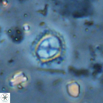 Rotelapillus tesserisbares 35846