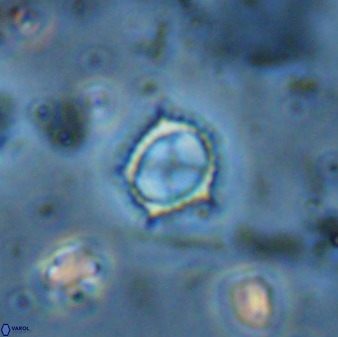 Rotelapillus tesserisbares 35847