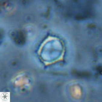 Rotelapillus tesserisbares 35847