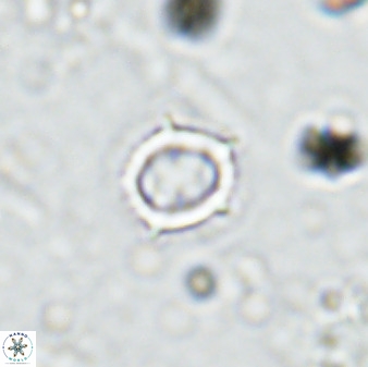 Rotelapillus tesserisbares 35848