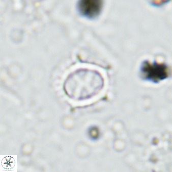 Rotelapillus tesserisbares 35849