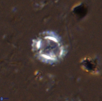 Rotelapillus tesserisbares 35850