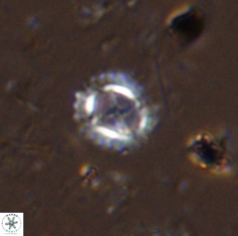 Rotelapillus tesserisbares 35850