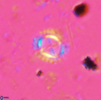 Rotelapillus tesserisbares 35851