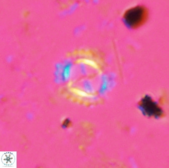 Rotelapillus tesserisbares 35851