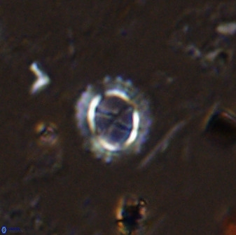 Rotelapillus tesserisbares 35852