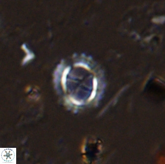 Rotelapillus tesserisbares 35852